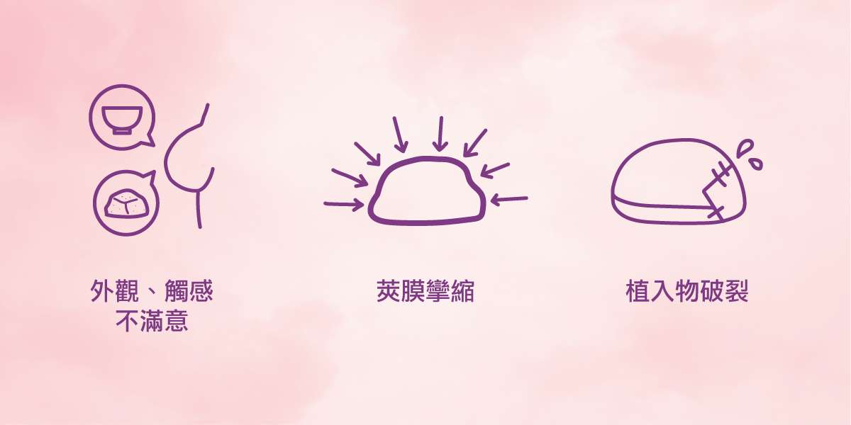 隆乳手術風險