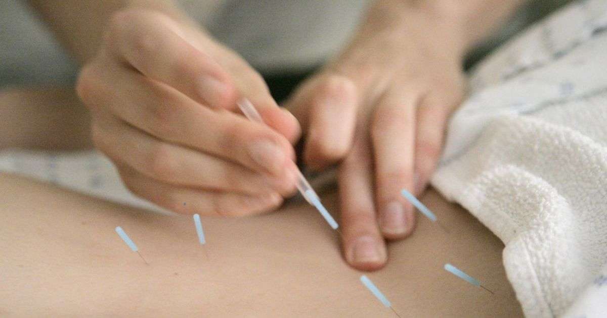 中醫針灸