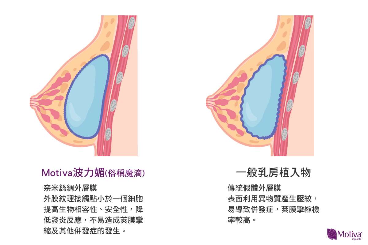 波力媚(俗抽魔滴)與其他填入物比較