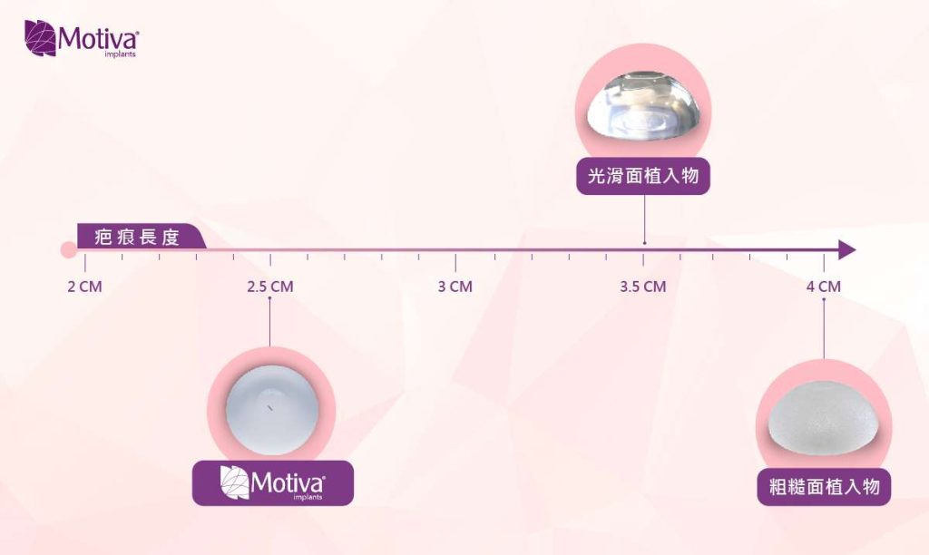 Motiva魔滴®隆乳疤痕傷口小，術後方便照顧