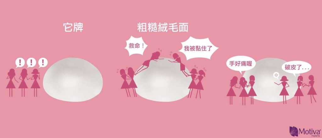 隆乳絨毛面缺點