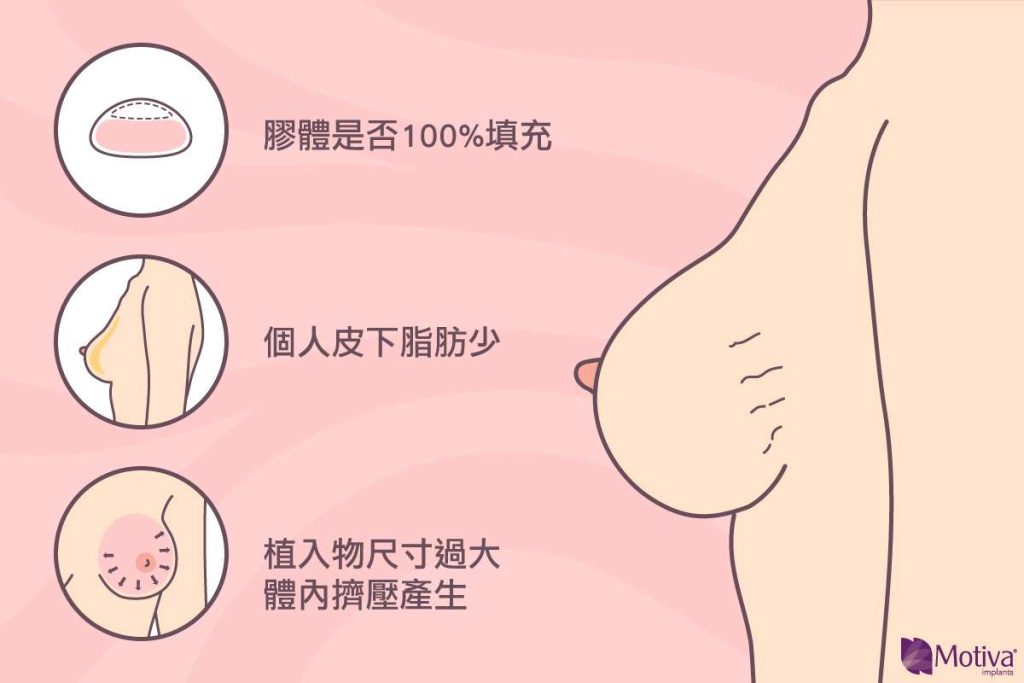 水波紋原因