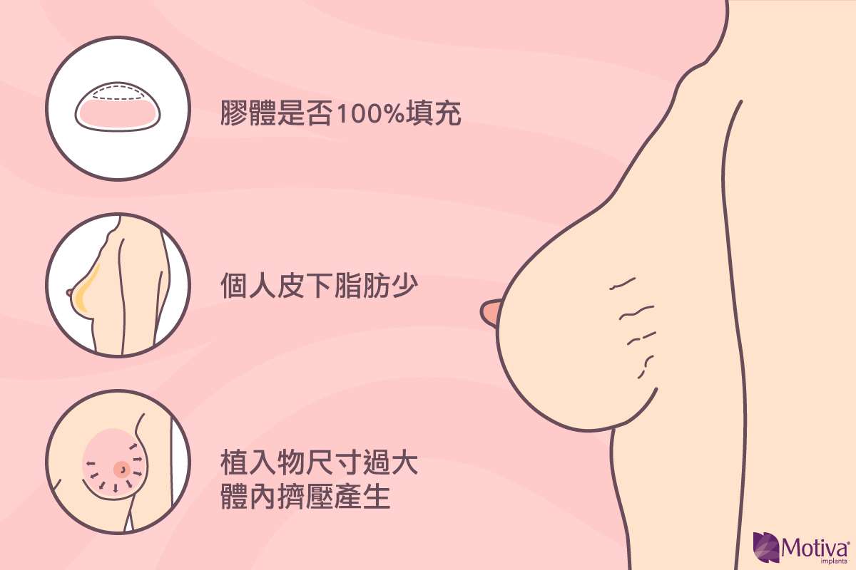 水波紋原因