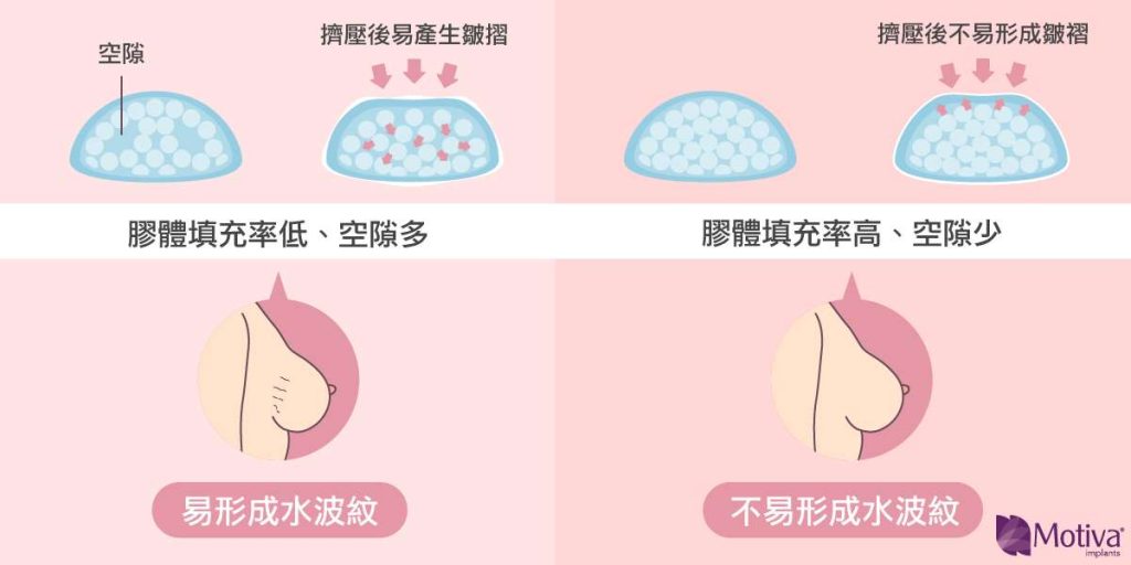 水波紋