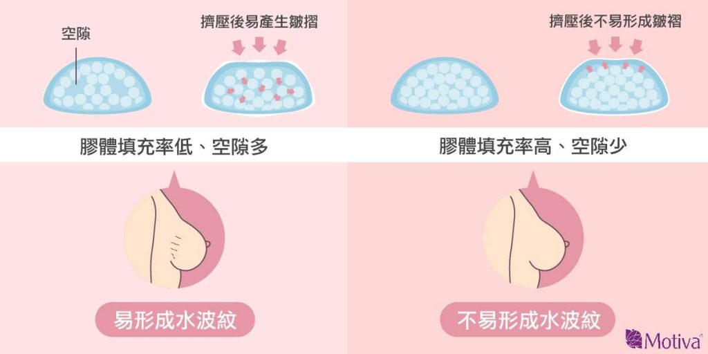 魔滴隆乳100%填充率與水波紋的關係圖說 