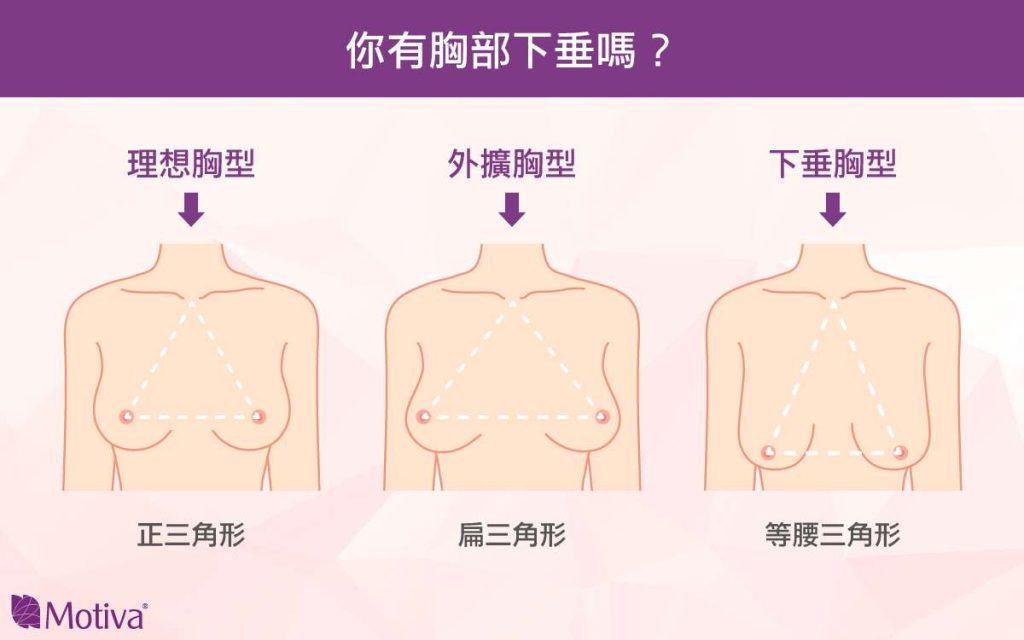 檢視自己是否有乳房下垂的圖說