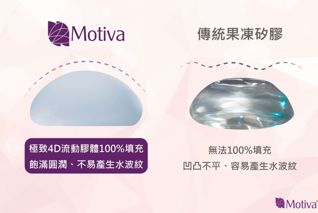 Motiva魔滴的極致4D流動膠體，內聚力、流動性佳，能夠做到100%填充