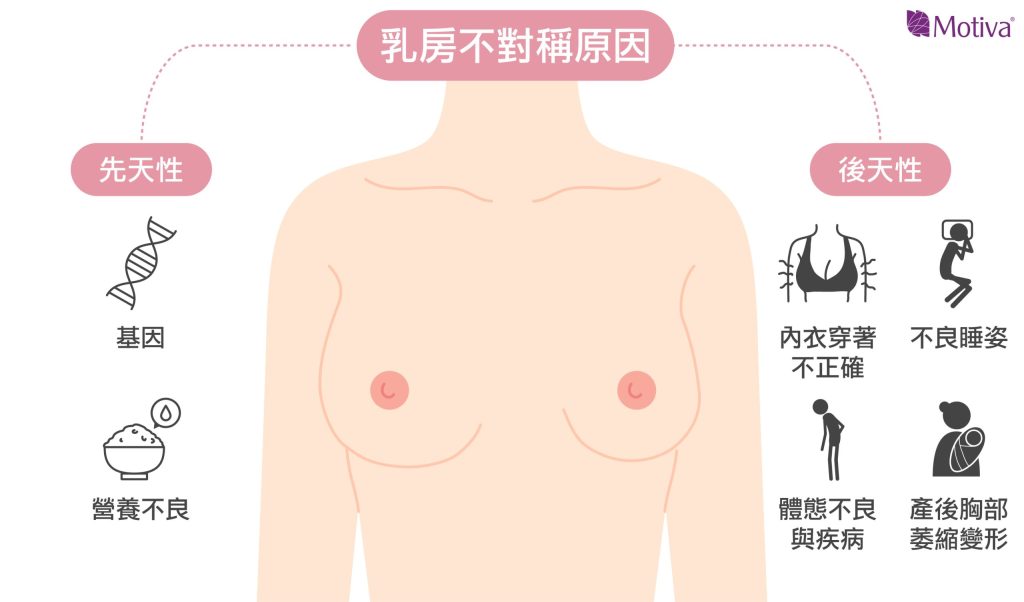 女生為什麼胸部左右邊不一樣大