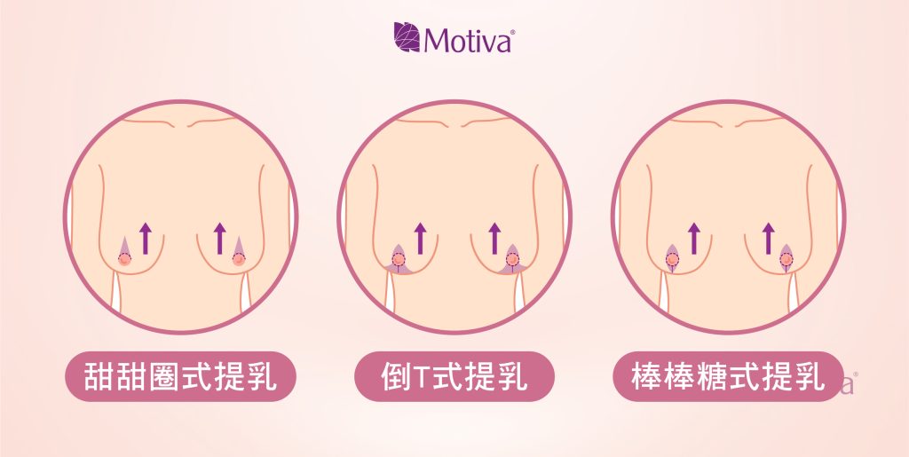 提乳手術的3種方式