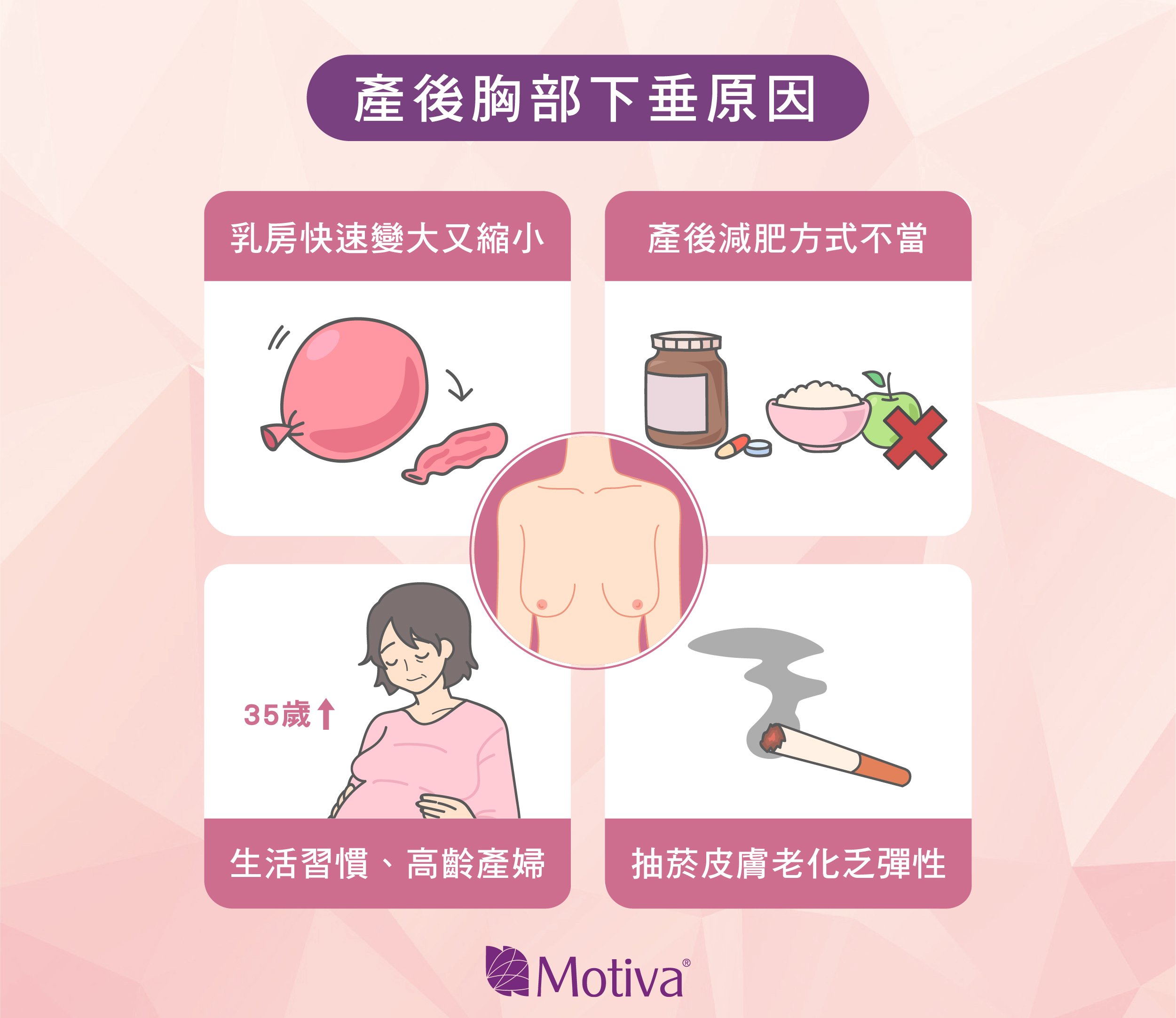 產後胸部為什麼會下垂圖說
