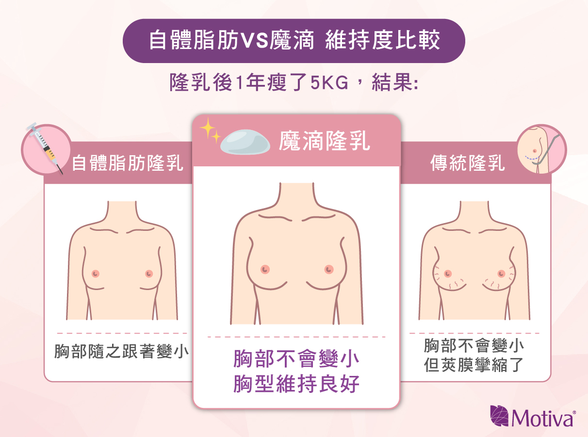 自體脂肪隆乳與魔滴隆乳，維持比較