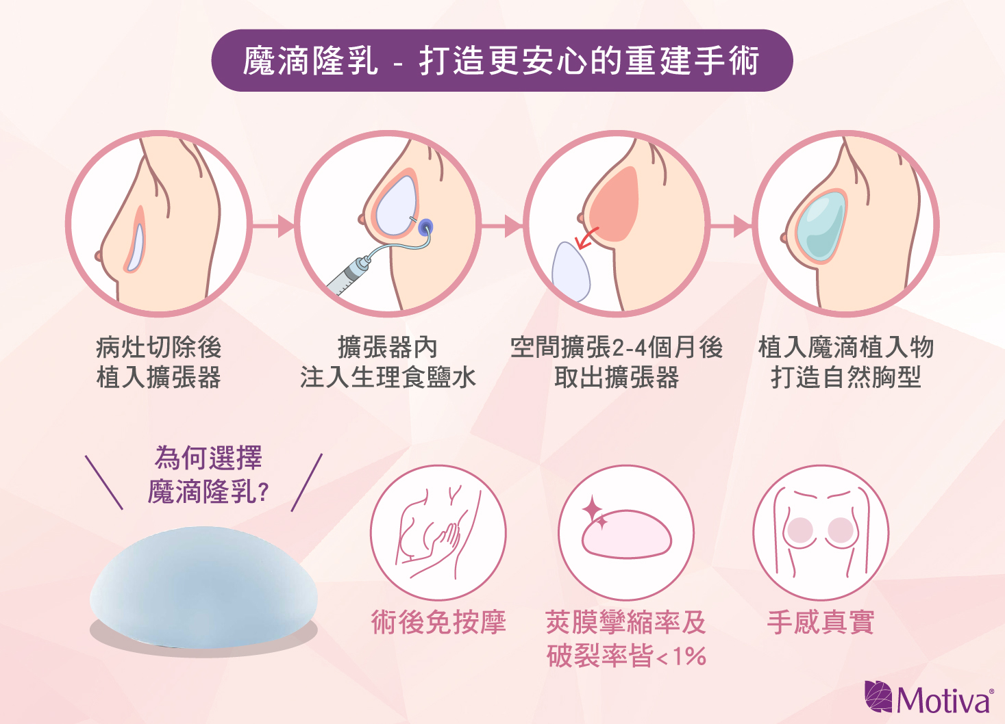 乳癌重建