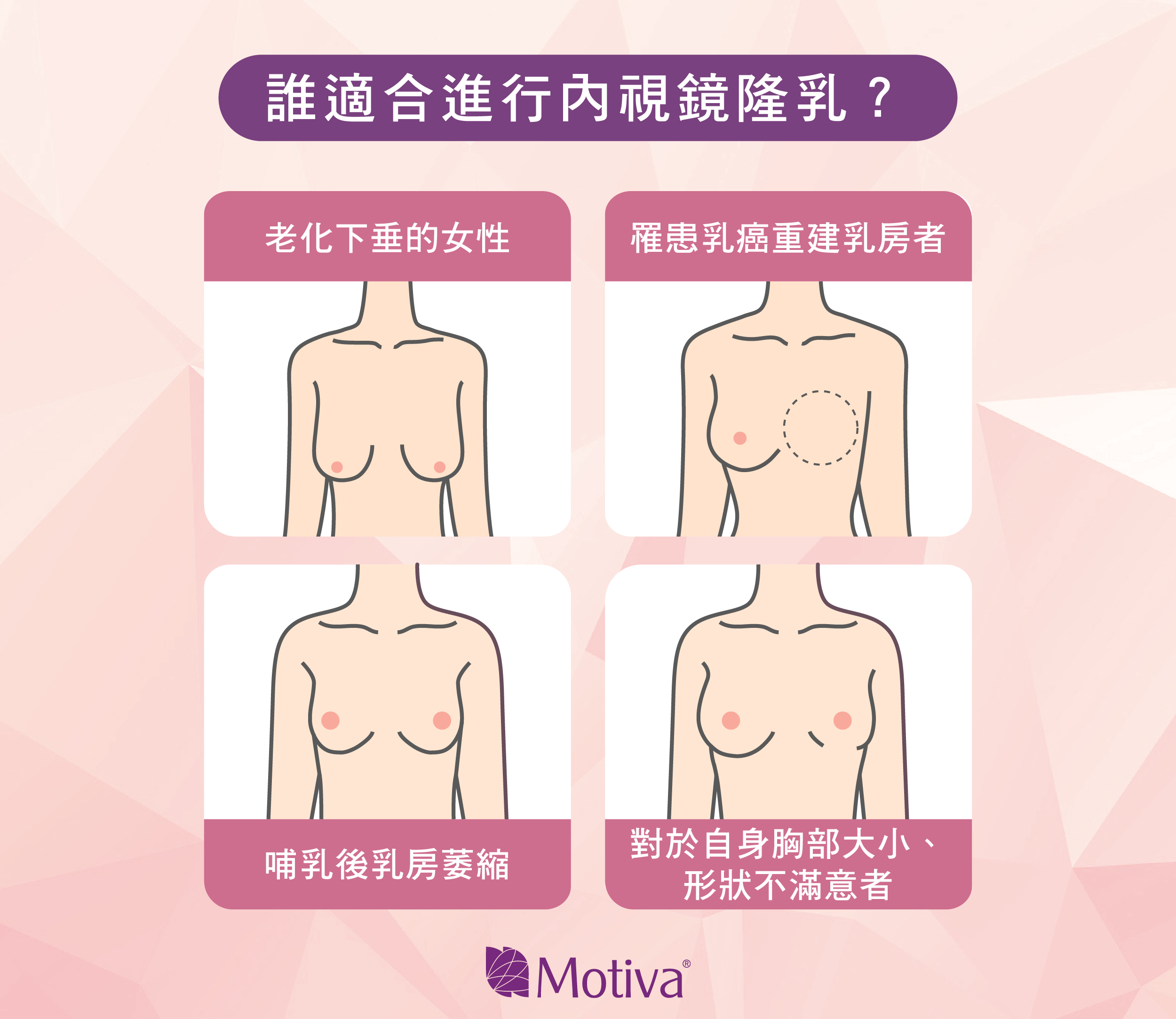 誰適合進行內視鏡隆乳