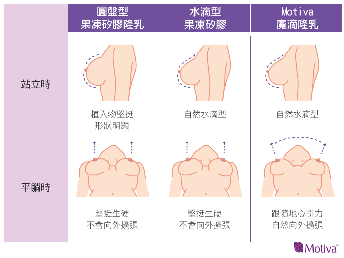 假體比較