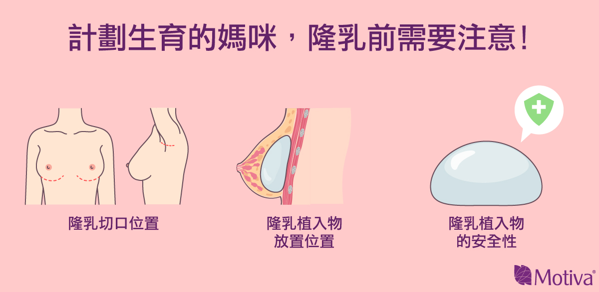 計劃生育的媽咪隆乳前需要注意事項